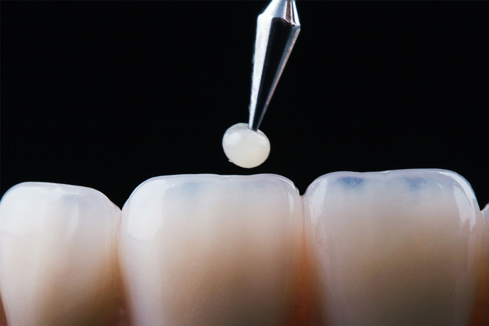 Restorative dentistry in St. Jacobs being performed at St. Jacobs Dental Care